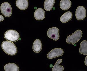 Diseñada una nueva herramienta bioinformática para identificar las ...