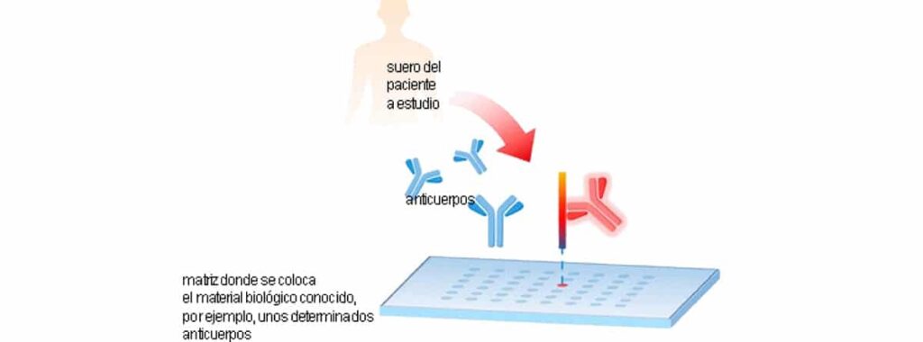 Diagnóstico por microarrays: cuándo se usa -canalSALUD